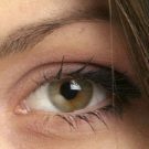 知っておきたい二重整形の2つの種類